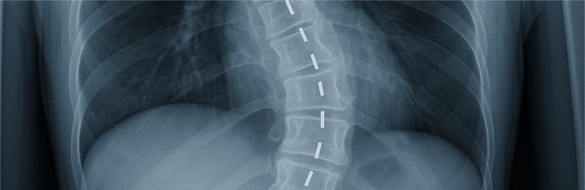 scoliosis chiropractor jacksonville